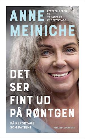 Det ser fint ud på røntgen: På reportage som patient